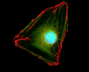 ICC/IF staining of HeLa cells using recombinant Paxillin antibody (red). Actin filaments have been labeled with fluorescein phalloidin (green), and nucleus labeled with DAPI (blue).