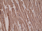 IHC testing of FFPE human heart tissue with recombinant ACTC1 antibody at 1:1000.