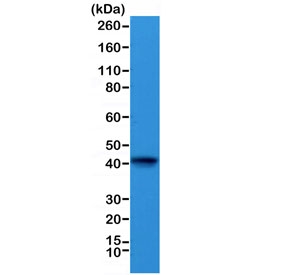 Western blot testing of mouse heart lysate with recombinant ACTC1 antibody at 1:1000. Predicted molecular weight ~42 kDa.~