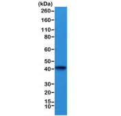 Western blot testing of mouse heart lysate with recombinant ACTC1 antibody at 1:1000. Predicted molecular weight ~42 kDa.