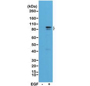 Western blot of A431 cell lysate, untreated (-) or treated (+) with EGF, using recombinant phospho-Stat3 antibody at 1:1000.~