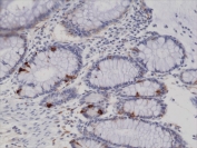 IHC testing of FFPE human colon tissue with recombinant Synaptophysin antibody. 