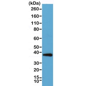 Western blot testing of human HeLa cell lysate with recombinant Synaptophysin antibody. Predicted molecular weight: 34-38 kDa.~