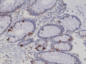 IHC testing of FFPE human colon tissue with recombinant Synaptophysin antibody.
