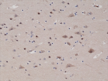 IHC testing of FFPE human brain tissue with recombinant PTEN antibody at 1:1000. ~
