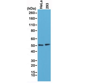 Western blot testing of human HeLa and 293 cell lysate with recombinant PTEN antibody at 1:1000. Expected molecular weight: 47~55 kDa (isoform 1), 65~70