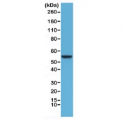 Western blot testing of human HeLa cell lysate with recombinant CK8 antibody at 1:1000. Predicted molecular weight ~56 kDa.