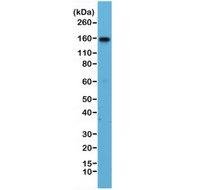 Western blot testing of human Jurkat cell lysate with recombinant ITGA4 antibody at 1:1000. Predicted molecular weight ~115 kDa, routinely observed at ~150 kDa.~
