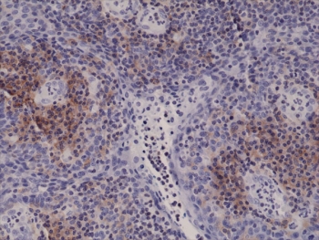 IHC testing of FFPE human tonsil tissue with recombinant ITGA4 antibody a