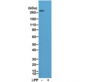 Western blot of A431 cell lysate, untreated (-) or treated (+) with Lambda Protein Phosphatase (Î»PP), using recombinant phospho-ACC antibody at 1:1000.