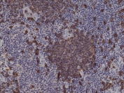 IHC testing of FFPE human tonsil tissue with recombinant CD20 antibody at 1:1000.