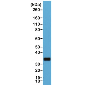 Western blot of human Raji cell lysate using recombinant CD20 antibody at 1:1000. Predicted molecular weight ~33 kDa.~