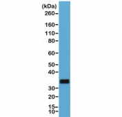 Western blot of human Raji cell lysate using recombinant CD20 antibody at 1:1000. Predicted molecular weight ~33 kDa.