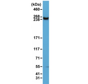 Western blot of human HeLa cell lysate using recombinant mTOR antibody at 1:1500. Predicted molecular weight ~280 kDa, also observed at ~220 kDa.~