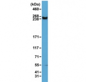 Western blot of human HeLa cell lysate using recombinant mTOR antibody at 1:1500. Predicted molecular weight ~280 kDa, also observed at ~220 kDa.