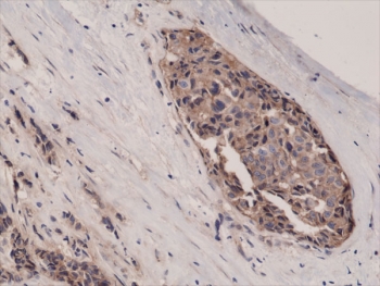 IHC testing of FFPE human breast cancer tissue with recombinant