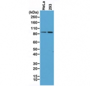 Western blot of human HeLa and 293 cell lysate using recombinant Beta Catenin antibody at 1:400. Predicted molecular weight ~85 kDa, but routinely observed at 90-95 kDa.