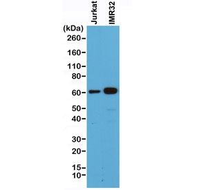 Western blot of human Jurkat and IMR32 cell lysate using recombinant SMAD4 antibody at 1:500. Predicted molecular weight ~60 kDa.~
