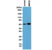 Western blot of human Jurkat and IMR32 cell lysate using recombinant SMAD4 antibody at 1:500. Predicted molecular weight ~60 kDa.