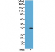 Western blot of HeLa cell lysate, untreated (-) or treated (+) with Nocodazole (NOC), using recombinant Aurora B antibody at 1:1000. Predicted molecular weight: 39~45 kDa.