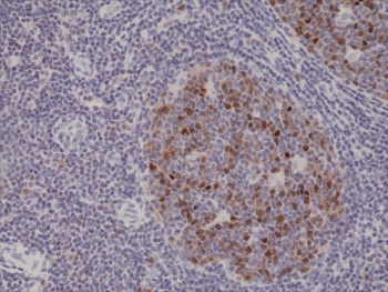 IHC testing of FFPE human tonsil tissue with recombinant Aurora B antibody at 1:1000.~