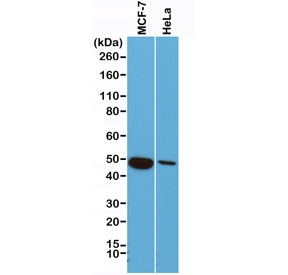 Western blot of human MCF7 and HeLa cell lysate using recombinant Cytokeratin 18 antibody at 1:1000. Predicted molecular weight ~48 kDa.~