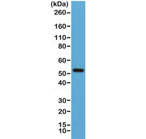 Western blot of human Jurkat lysate using recombinant Cyclin B1 antibody at 1:1000. Predicted molecular weight: 48-60 kDa.~