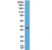 Western blot of human A431 lysate using recombinant CK20 antibody at 1:1000. Predicted molecular weight ~49 kDa.