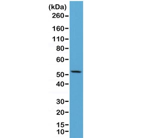 Western blot of human HeLa lysate using recombinant CK7 antibody at 1:2500. Predicted molecular weight ~51 kDa.~