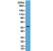 Western blot of human HeLa lysate using recombinant CK7 antibody at 1:2500. Predicted molecular weight ~51 kDa.