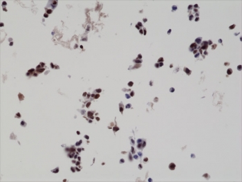 IHC staining of formalin fixed and paraffin embedded human LNCaP cell