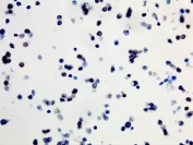 ICC staining of formalin fixed and paraffin embedded human SW40 cells (400X, Negative) with recombinant BRAF V600E antibody. HIER: steam section in pH6 citrate buffer for 20 min and allow to cool prior to testing.