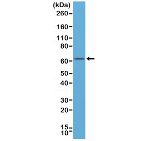 Western blot of human MCF-7 cell lysates using recombinant Estrogen Receptor alpha antibody at a 1:500 dilution. Predicted molecular weight ~66 kDa.~