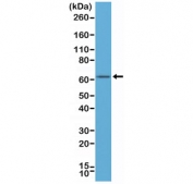 Western blot of human MCF-7 cell lysates using recombinant Estrogen Receptor alpha antibody at a 1:500 dilution. Predicted molecular weight ~66 kDa.