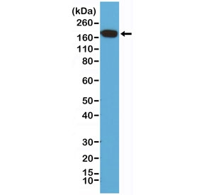 Western blot of human HeLa cell lysate using recombinant EGFR antibody at a 1:200 dilution. Expected molecular weight: 134-180 kDa depending on glycosylation level.~