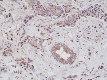 IHC staining of formalin fixed and paraffin embedded human breast can