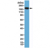 Western blot of human HeLa cell lysate using recombinant EGFR antibody at a 1:200 dilution. Expected molecular weight: 134-180 kDa depending on glycosylation level.