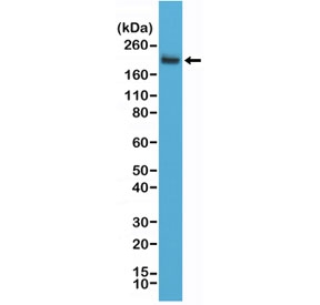 Western blot testing of human Jurkat cell lysate using recombinant CD45 antibody at a 1:2000 dilution. Expected molecular weight: 147-220 kDa depending on glycosylation level.~