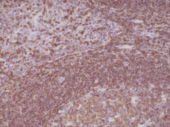 IHC staining of formalin fixed and paraffin embedded human
