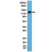 Western blot testing of human HeLa cell lysate with recombinant ITGB1 antibody at 1:4000 dilution. Predicted molecular weight: 88-150 kDa depending on glycosylation level.