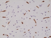 IHC testing of formalin fixed and paraffin embedded human brain tissue with recombinant ITGB1 antibody at 1:200 dilution. HIER: steam section in pH6 citrate buffer for 20 min and allow to cool prior to staining.