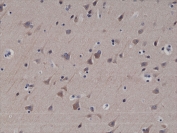 IHC testing of formalin fixed and paraffin embedded human brain tissue with recombinant LC3B antibody at 1:200 dilution. HIER: steam section in pH6 citrate buffer for 20 min and allow to cool prior to staining.