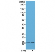 Western blot testing of lysate from HeLa cells, untreated or treated with chloroquine (CHQ), with recombinant LC3B antibody at 1:200 dilution. Predicted molecular weight ~15 kDa.