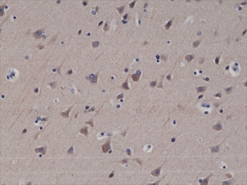 IHC testing of formalin fixed and paraffin embedded human brain tissue with recombinant LC3B antibody at 1:200 dilution. HIER: steam section in pH6 citrate buffer for 20 min and allow to cool prior to staining.
