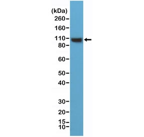 Western blot testing of human HeLa cell lysate with recombinant ACTN4 antibody at 1:1000 dilution. Predicted molecular weight ~105 kDa.~