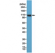 Western blot testing of human HeLa cell lysate with recombinant ACTN4 antibody at 1:1000 dilution. Predicted molecular weight ~105 kDa.