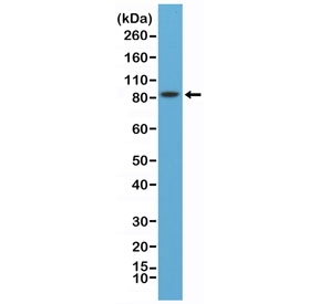 Western blot testing of mouse brain lysate with recombinant PSD95 antibody at 1:8000 dilution. Predicted molecular weight ~80 kDa but often observed at 90~95 kDa.~