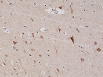 IHC testing of formalin fixed and paraffin embedded human brain tissue
