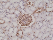 IHC testing of formalin fixed and paraffin embedded human kidney tissue with recombinant Vimentin antibody at 1:200 dilution. HIER: steam section in pH6 citrate buffer for 20 min and allow to cool prior to staining.