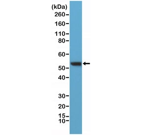 Western blot testing of human HeLa lysate with recombinant Vimentin antibody at 1:400 dilution. Predicted molecular weight ~53 kDa.~